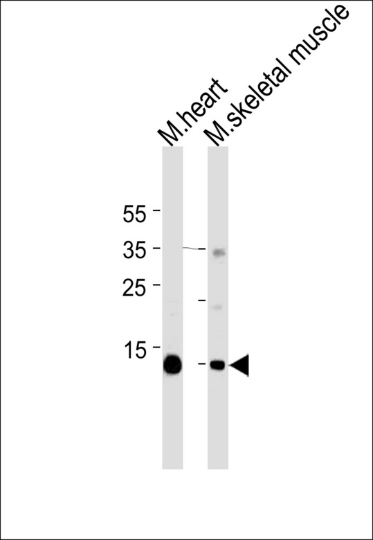 MB / Myoglobin Antibody - Western blot of lysates from mouse heart and skeletal muscle tissue lysates (from left to right) with Myoglobin Antibody. Antibody was diluted at 1:1000 at each lane. A goat anti-mouse IgG H&L (HRP) at 1:3000 dilution was used as the secondary antibody. Lysates at 35 ug per lane.
