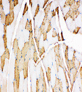 MB / Myoglobin Antibody - MB / Myoglobin antibody. IHC(P): Rat Skeletal Muscle Tissue.