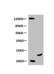MB / Myoglobin Antibody - All lanes:Mouse anti-Human Myoglobin monoclonal antibody at 0.3ug/ml Lane 1:mouse heart muscle lysate Lane 2:Recombinant Myoglobin at 10ug Secondary:HRP labeled Goat polyclonal to Mouse IgG at 1/3000 dilution Predicted band size : 17kd Observed band size : 20kd Additional bands at:120KD