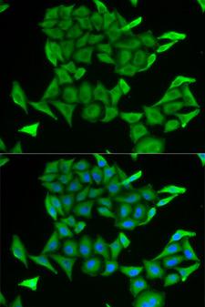 MB / Myoglobin Antibody - Immunofluorescence analysis of HeLa cells.