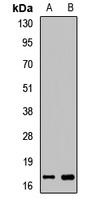 MB / Myoglobin Antibody