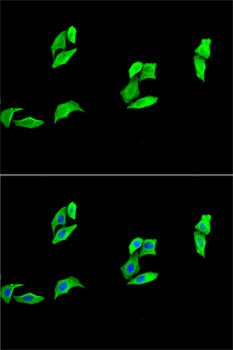 MB / Myoglobin Antibody - Immunofluorescence analysis of A-549 cells using MB antibody. Blue: DAPI for nuclear staining.