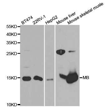 MB / Myoglobin Antibody - Western blot analysis of extracts of various cell lines, using MB antibody at 1:1000 dilution. The secondary antibody used was an HRP Goat Anti-Rabbit IgG (H+L) at 1:10000 dilution. Lysates were loaded 25ug per lane and 3% nonfat dry milk in TBST was used for blocking. An ECL Kit was used for detection and the exposure time was 5s.