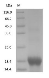 MB / Myoglobin Protein - (Tris-Glycine gel) Discontinuous SDS-PAGE (reduced) with 5% enrichment gel and 15% separation gel.