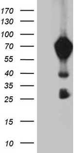 MBD1 Antibody - HEK293T cells were transfected with the pCMV6-ENTRY control. (Left lane) or pCMV6-ENTRY MBD1. (Right lane) cDNA for 48 hrs and lysed. Equivalent amounts of cell lysates. (5 ug per lane) were separated by SDS-PAGE and immunoblotted with anti-MBD1. (1:2000)
