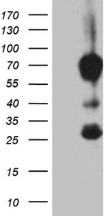 MBD1 Antibody - HEK293T cells were transfected with the pCMV6-ENTRY control. (Left lane) or pCMV6-ENTRY MBD1. (Right lane) cDNA for 48 hrs and lysed. Equivalent amounts of cell lysates. (5 ug per lane) were separated by SDS-PAGE and immunoblotted with anti-MBD1. (1:2000)