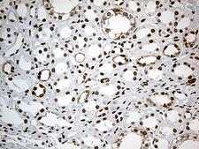 MBD1 Antibody - Immunohistochemical staining of paraffin-embedded Human Kidney tissue within the normal limits using anti-MBD1 mouse monoclonal antibody. (Heat-induced epitope retrieval by 1mM EDTA in 10mM Tris buffer. (pH8.5) at 120°C for 3 min. (1:500)