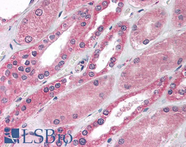 MBD1 Antibody - Anti-MBD1 antibody IHC of human kidney. Immunohistochemistry of formalin-fixed, paraffin-embedded tissue after heat-induced antigen retrieval. Antibody concentration 10 ug/ml.  This image was taken for the unconjugated form of this product. Other forms have not been tested.
