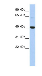 MBD1 Antibody - MBD1 antibody Western blot of HepG2 cell lysate. This image was taken for the unconjugated form of this product. Other forms have not been tested.