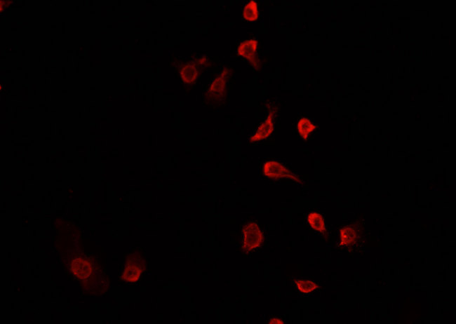 MBD1 Antibody - Staining HepG2 cells by IF/ICC. The samples were fixed with PFA and permeabilized in 0.1% Triton X-100, then blocked in 10% serum for 45 min at 25°C. The primary antibody was diluted at 1:200 and incubated with the sample for 1 hour at 37°C. An Alexa Fluor 594 conjugated goat anti-rabbit IgG (H+L) antibody, diluted at 1/600, was used as secondary antibody.