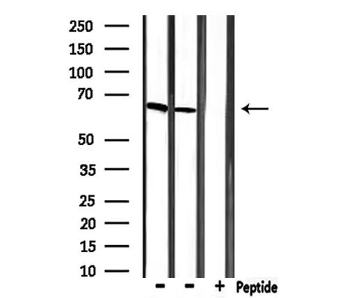 MBD1 Antibody - Western blot analysis of extracts of 293 cells and HeLa cells using MBD1 antibody.