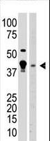 MBD2 Antibody - The anti-MBD2 N-term Antibody is used in Western blot to detect MBD2 in A375 cell lysate (lane 1) and mouse brain tissue lysate (lane 2) lysate.