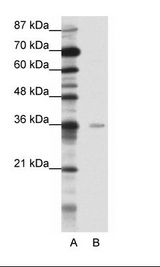 MBD2 Antibody - A: Marker, B: HepG2 Cell Lysate.  This image was taken for the unconjugated form of this product. Other forms have not been tested.