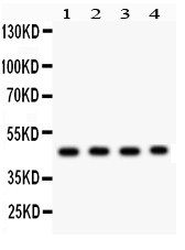 MBD2 Antibody - MBD2 antibody Western blot. All lanes: Anti MBD2 at 0.5 ug/ml. Lane 1: SGC Whole Cell Lysate at 40 ug. Lane 2: HELA Whole Cell Lysate at 40 ug. Lane 3: JURKAT Whole Cell Lysate at 40 ug. Lane 4: K562 Whole Cell Lysate at 40 ug. Predicted band size: 47 kD. Observed band size: 47 kD.