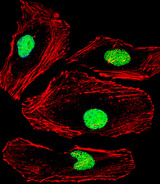 MBD2 Antibody - Fluorescent confocal image of HeLa cell stained with MBD2 Antibody. HeLa cells were fixed with 4% PFA (20 min), permeabilized with Triton X-100 (0.1%, 10 min), then incubated with MBD2 primary antibody (1:25, 1 h at 37°C). For secondary antibody, Alexa Fluor 488 conjugated donkey anti-rabbit antibody (green) was used (1:400, 50 min at 37°C). Cytoplasmic actin was counterstained with Alexa Fluor 555 (red) conjugated Phalloidin (7units/ml, 1 h at 37°C). Nuclei were counterstained with DAPI (blue) (10 ug/ml, 10 min). MBD2 immunoreactivity is localized to Nucleus significantly.