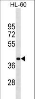 MBD2 Antibody - MBD2 Antibody western blot of HL-60 cell line lysates (35 ug/lane). The MBD2 antibody detected the MBD2 protein (arrow).