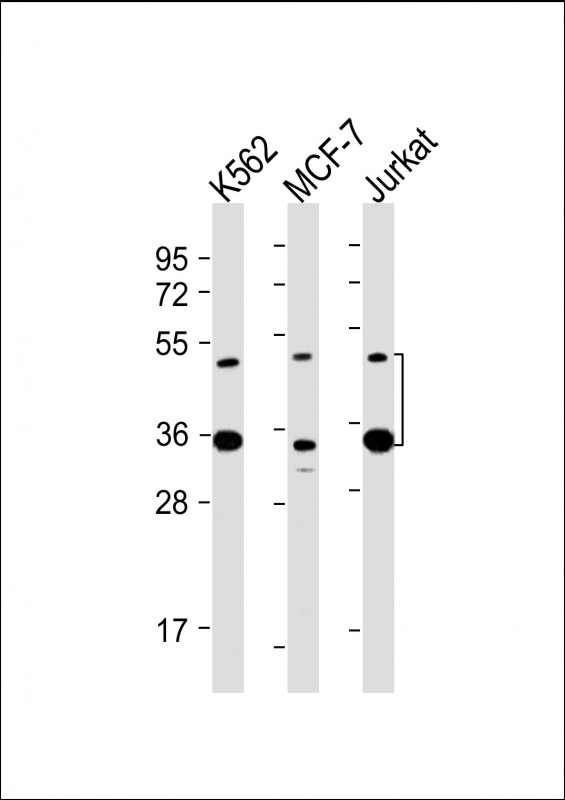 MBD2 Antibody - All lanes: Anti-MBD2 Antibody at 1:2000 dilution Lane 1: K562 whole cell lysate Lane 2: MCF-7 whole cell lysate Lane 3: Jurkat whole cell lysate Lysates/proteins at 20 µg per lane. Secondary Goat Anti-mouse IgG, (H+L), Peroxidase conjugated at 1/10000 dilution. Predicted band size: 43 kDa Blocking/Dilution buffer: 5% NFDM/TBST.