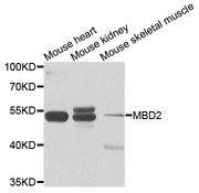 MBD2 Antibody - Western blot analysis of extracts of various cells.