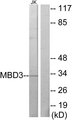 MBD3 Antibody - Western blot analysis of lysates from Jurkat cells, using MBD3 Antibody. The lane on the right is blocked with the synthesized peptide.