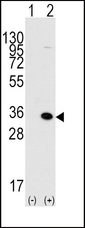 MBD3 Antibody - Western blot of MBD3 (arrow) using rabbit polyclonal MBD3 Antibody. 293 cell lysates (2 ug/lane) either nontransfected (Lane 1) or transiently transfected with the MBD3 gene (Lane 2) (Origene Technologies).