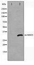 MBD3 Antibody - Western blot of Jurkat cell lysate using MBD3 Antibody