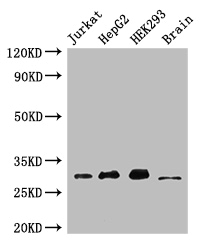 MBD3 Antibody - Positive WB detected in:Jurkat whole cell lysate,HepG2 whole cell lysate,HEK293 whole cell lysate,Mouse brain tissue;All lanes:MBD3 antibody at 3ug/ml;Secondary;Goat polyclonal to rabbit IgG at 1/50000 dilution;Predicted band size: 33,30 kDa;Observed band size: 33 kDa;