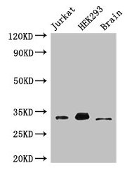 MBD3 Antibody - Western Blot Positive WB detected in: Jurkat whole cell lysate, HEK293 whole cell lysate, Mouse brain tissue All lanes: MBD3 antibody at 3µg/ml Secondary Goat polyclonal to rabbit IgG at 1/50000 dilution Predicted band size: 33, 30 kDa Observed band size: 33 kDa