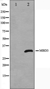 MBD3 Antibody - Western blot analysis on Jurkat cell lysates using MBD3 antibody. The lane on the left is treated with the antigen-specific peptide.