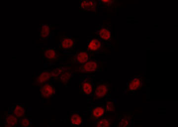 MBD3 Antibody - Staining HeLa cells by IF/ICC. The samples were fixed with PFA and permeabilized in 0.1% Triton X-100, then blocked in 10% serum for 45 min at 25°C. The primary antibody was diluted at 1:200 and incubated with the sample for 1 hour at 37°C. An Alexa Fluor 594 conjugated goat anti-rabbit IgG (H+L) Ab, diluted at 1/600, was used as the secondary antibody.