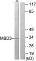 MBD3 Antibody - Western blot analysis of extracts from Jurkat cells, using MBD3 antibody.