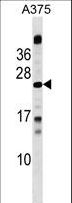 MBD3L1 Antibody - MBD3L1 Antibody western blot of A375 cell line lysates (35 ug/lane). The MBD3L1 antibody detected the MBD3L1 protein (arrow).