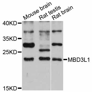 MBD3L1 Antibody - Western blot analysis of extracts of various cell lines, using MBD3L1 antibody at 1:3000 dilution. The secondary antibody used was an HRP Goat Anti-Rabbit IgG (H+L) at 1:10000 dilution. Lysates were loaded 25ug per lane and 3% nonfat dry milk in TBST was used for blocking. An ECL Kit was used for detection and the exposure time was 90s.