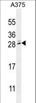 MBD3L2 Antibody - MBD3L2 Antibody western blot of A375 cell line lysates (35 ug/lane). The MBD3L2 antibody detected the MBD3L2 protein (arrow).