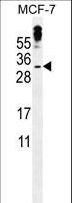MBD3L3 Antibody - MBD3L3 Antibody western blot of MCF-7 cell line lysates (35 ug/lane). The MBD3L3 antibody detected the MBD3L3 protein (arrow).