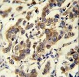 MBD3L3 Antibody - MBD3L3 Antibody immunohistochemistry of formalin-fixed and paraffin-embedded human testis carcinoma followed by peroxidase-conjugated secondary antibody and DAB staining.