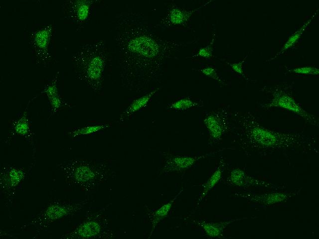 MBD5 Antibody - Immunofluorescence staining of MBD5 in HeLa cells. Cells were fixed with 4% PFA, permeabilzed with 0.1% Triton X-100 in PBS, blocked with 10% serum, and incubated with rabbit anti-Human MBD5 polyclonal antibody (dilution ratio 1:1000) at 4°C overnight. Then cells were stained with the Alexa Fluor 488-conjugated Goat Anti-rabbit IgG secondary antibody (green). Positive staining was localized to Nucleus.