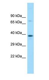 MBIP Antibody - MBIP antibody Western Blot of Fetal Bladder.  This image was taken for the unconjugated form of this product. Other forms have not been tested.