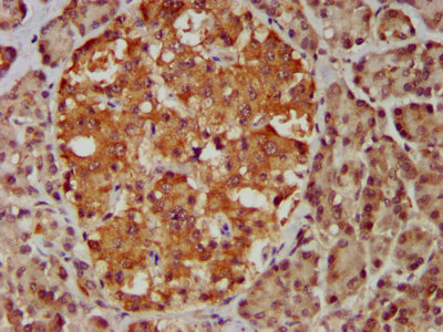 MBIP Antibody - Immunohistochemistry image at a dilution of 1:400 and staining in paraffin-embedded human pancreatic tissue performed on a Leica BondTM system. After dewaxing and hydration, antigen retrieval was mediated by high pressure in a citrate buffer (pH 6.0) . Section was blocked with 10% normal goat serum 30min at RT. Then primary antibody (1% BSA) was incubated at 4 °C overnight. The primary is detected by a biotinylated secondary antibody and visualized using an HRP conjugated SP system.