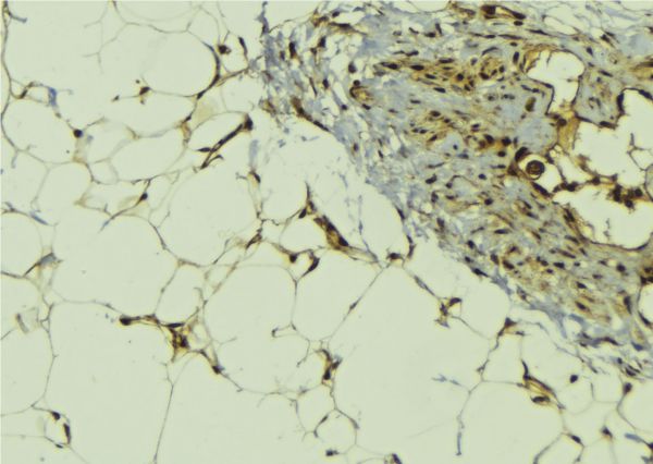 MBIP Antibody - 1:100 staining human lung tissue by IHC-P. The sample was formaldehyde fixed and a heat mediated antigen retrieval step in citrate buffer was performed. The sample was then blocked and incubated with the antibody for 1.5 hours at 22°C. An HRP conjugated goat anti-rabbit antibody was used as the secondary.