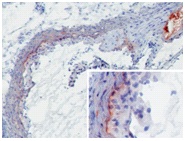 Mbl1 Antibody - MBL-A (8G6) deposition in developing murine atherosclerotic lesions. Staining of frozen tissue sections with antibody 8G6. Anti-mouse MBL-A at 2 ug/ml (2h, RT). MBL-A was detected on the intima to media border as well as throughout the media (insert). Furthermore, extensive MBL-A deposition was seen at sites of necrosis (upper right corner).