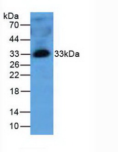 MBL2 / Mannose Binding Protein Antibody - Western Blot; Sample: Human Plasma Tissue.