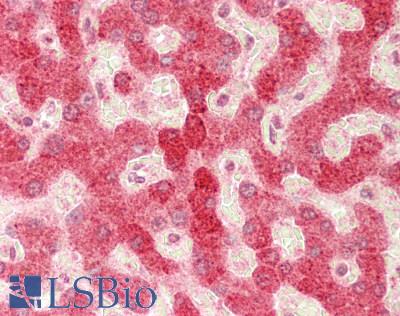 MBL2 / Mannose Binding Protein Antibody - Human Liver: Formalin-Fixed, Paraffin-Embedded (FFPE)