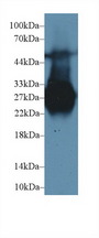 MBL2 / Mannose Binding Protein Antibody - Western Blot; Sample: Rat Liver lysate; Primary Ab: 1µg/ml Rabbit Anti-Rat MBL Antibody Second Ab: 0.2µg/mL HRP-Linked Caprine Anti-Rabbit IgG Polyclonal Antibody