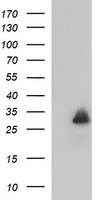 MBL2 / Mannose Binding Protein Antibody - HEK293T cells were transfected with the pCMV6-ENTRY control (Left lane) or pCMV6-ENTRY MBL2 (Right lane) cDNA for 48 hrs and lysed. Equivalent amounts of cell lysates (5 ug per lane) were separated by SDS-PAGE and immunoblotted with anti-MBL2.