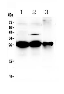 MBL2 / Mannose Binding Protein Antibody - Western blot - Anti-MBL2/Mannan Binding Lectin Picoband Antibody