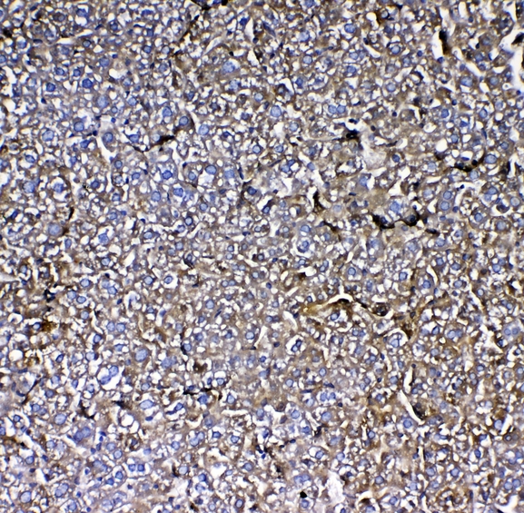 MBL2 / Mannose Binding Protein Antibody - IHC analysis of MBL2 using anti-MBL2 antibody. MBL2 was detected in paraffin-embedded section of mouse liver tissue. Heat mediated antigen retrieval was performed in citrate buffer (pH6, epitope retrieval solution) for 20 mins. The tissue section was blocked with 10% goat serum. The tissue section was then incubated with 1µg/ml rabbit anti-MBL2 Antibody overnight at 4°C. Biotinylated goat anti-rabbit IgG was used as secondary antibody and incubated for 30 minutes at 37°C. The tissue section was developed using Strepavidin-Biotin-Complex (SABC) with DAB as the chromogen.