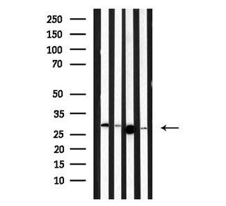 MBL2 / Mannose Binding Protein Antibody - Western blot analysis of MBL2 expression in various lysates