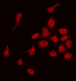 MBL2 / Mannose Binding Protein Antibody - Staining HepG2 cells by IF/ICC. The samples were fixed with PFA and permeabilized in 0.1% Triton X-100, then blocked in 10% serum for 45 min at 25°C. The primary antibody was diluted at 1:200 and incubated with the sample for 1 hour at 37°C. An Alexa Fluor 594 conjugated goat anti-rabbit IgG (H+L) Ab, diluted at 1/600, was used as the secondary antibody.