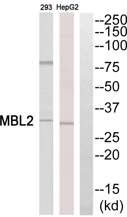 MBL2 / Mannose Binding Protein Antibody - Western blot analysis of extracts from HepG2 cells and 293 cells, using MBL2 antibody.