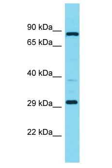 MBLAC1 Antibody - MBLAC1 antibody Western Blot of Fetal Liver. Antibody dilution: 1 ug/ml.  This image was taken for the unconjugated form of this product. Other forms have not been tested.